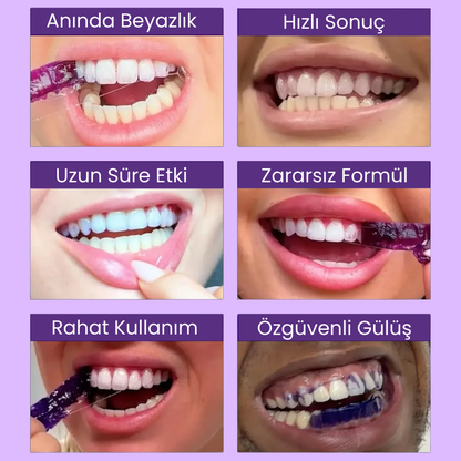Ekstra Güçlü Diş Beyazlatma Bandı