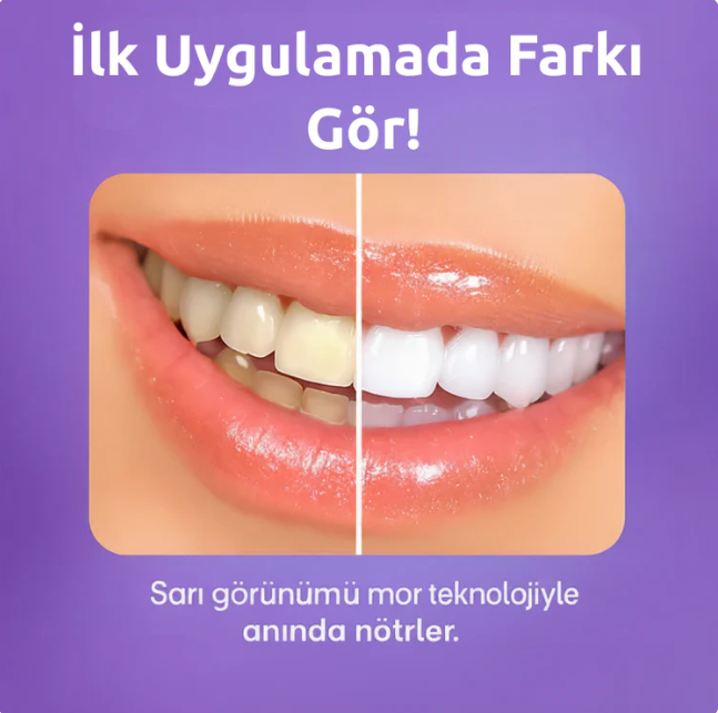 Ekstra Güçlü Diş Beyazlatma Bandı