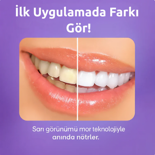 Ekstra Güçlü Diş Beyazlatma Bandı